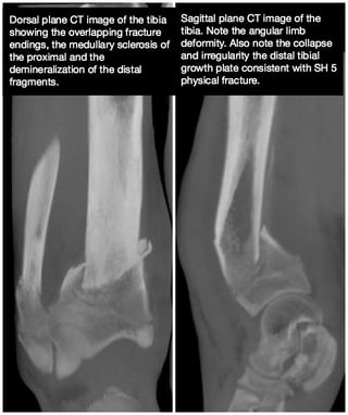 Tiger-ct-fracture.jpg Tiger-ct-fracture.jpg